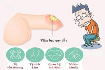 Bệnh viêm quy đầu là gì?