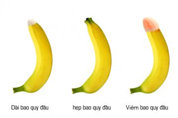 Hẹp bao quy đầu là gì? Nguyên nhân cách chữa hẹp bao quy đầu